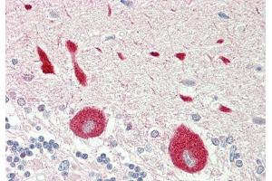 Rabbit Anti-STYK1 antibody  Formalin Fixed Paraffin Embedded Tissue: Human Brain, Cerebellum Primary antibody Concentration: 1:100 Secondary Antibody: Donkey anti-Rabbit-Cy3 Secondary Antibody Concentration: 1:200 Magnification: 20x Exposure Time: 0.