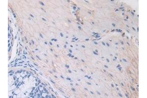 Detection of THBS1 in Mouse Colon Tissue using Polyclonal Antibody to Thrombospondin 1 (THBS1)