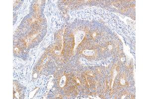 Immunohistochemistry (IHC) image for anti-Metastasis Associated in Colon Cancer 1 (MACC1) (AA 100-150) antibody (ABIN7453975)