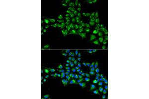 Immunofluorescence analysis of HeLa cells using CYGB antibody (ABIN5973882). (CYGB anticorps)