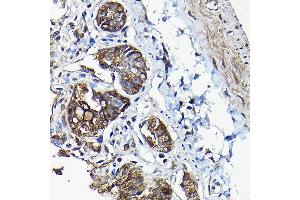 Immunohistochemistry of paraffin-embedded rat jejunum using  antibody (ABIN6127437, ABIN6136922, ABIN6136923 and ABIN6217829) at dilution of 1:50 (40x lens).