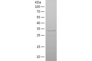 Western Blotting (WB) image for Scinderin (SCIN) (AA 600-715) protein (His-IF2DI Tag) (ABIN7124987)
