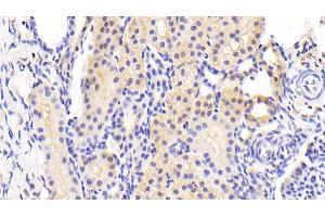 Detection of BCL2L11 in Human Kidney Tissue using Polyclonal Antibody to Bcl2 Like Protein 11 (BCL2L11)