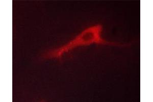 ABIN6267487 staining HeLa cells by ICC/IF.