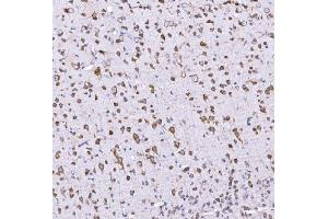 IHC analysis of Optineurin using anti-Optineurin antibody (ABIN3042498). (OPTN anticorps  (AA 241-577))