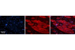 Rabbit Anti-ENO3 Antibody    Formalin Fixed Paraffin Embedded Tissue: Human Adult heart  Observed Staining: Cytoplasmic Primary Antibody Concentration: 1:100 Secondary Antibody: Donkey anti-Rabbit-Cy2/3 Secondary Antibody Concentration: 1:200 Magnification: 20X Exposure Time: 0. (ENO3 anticorps  (N-Term))