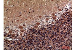 Immunohistochemistry (IHC) analysis of paraffin-embedded Human Brain, antibody was diluted at 1:100. (COL5A2 anticorps  (Internal Region))