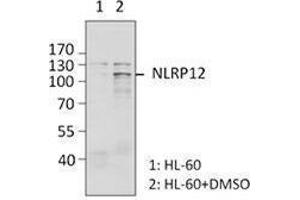 Western Blotting (WB) image for anti-NLR Family, Pyrin Domain Containing 12 (NLRP12) antibody (ABIN2665297) (NLRP12 anticorps)