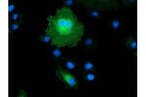 Anti-MAPRE2 mouse monoclonal antibody (ABIN2454619) immunofluorescent staining of COS7 cells transiently transfected by pCMV6-ENTRY MAPRE2 (RC200259). (MAPRE2 anticorps)