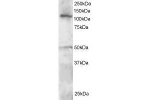 Western Blotting (WB) image for anti-Helicase-Like Transcription Factor (HLTF) (C-Term) antibody (ABIN2466282) (HLTF anticorps  (C-Term))