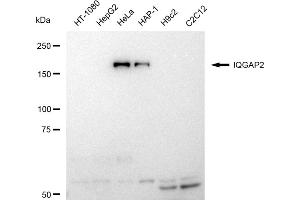 Western blotting analysis using IQGAP2 antibody (ABIN7799123).