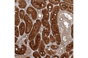 Immunohistochemical staining of human kidney with EXOC3L1 polyclonal antibody  shows strong cytoplasmic positivity in cells in tubules at 1:200-1:500 dilution. (EXOC3L1 anticorps)