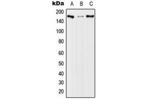 Western blot analysis of EGFR (pT678) expression in A431 EGF-treated (A), NIH3T3 EGF-treated (B), PC12 EGF-treated (C) whole cell lysates. (EGFR anticorps  (pSer678))