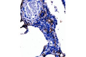 IHC analysis of Podoplanin/gp36/Pdpn using anti-Podoplanin/gp36/Pdpn antibody (ABIN7600811). (Podoplanin anticorps  (AA 24-172))