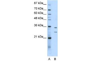 BXDC5 antibody used at 0. (RPF1 anticorps  (N-Term))