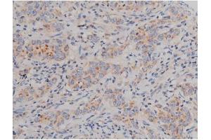 anti-Synuclein, alpha (SNCA) (pSer129) antibody