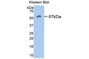 Western Blotting (WB) image for anti-Aldehyde Dehydrogenase 7 Family, Member A1 (ALDH7A1) (AA 29-539) antibody (ABIN1077760) (ALDH7A1 anticorps  (AA 29-539))