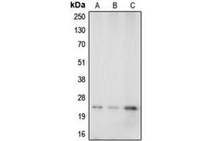Western blot analysis of Caveolin 1 expression in A549 (A), mouse brain (B), rat kidney (C) whole cell lysates.