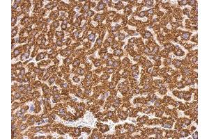 IHC-P Image ABAT antibody detects ABAT protein at mitochondria on mouse liver by immunohistochemical analysis.