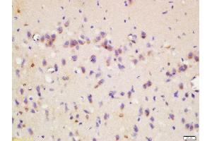 Formalin-fixed and paraffin embedded rat brain labeled with Rabbit Anti-Wnt8b Polyclonal Antibody, Unconjugated  at 1:200 followed by conjugation to the secondary antibody and DAB staining (WNT8B anticorps  (AA 131-230))
