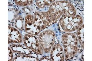 Immunohistochemical staining of paraffin-embedded liver tissue using anti-HDAC10 mouse monoclonal antibody. (HDAC10 anticorps)