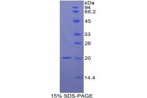 SDS-PAGE analysis of Rat Interleukin 17B Protein. (IL17B Protéine)
