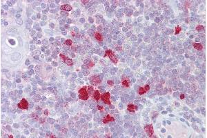 Immunohistochemistry with Thymus tissue at an antibody concentration of 5µg/ml using anti-DLX5 antibody (ARP31607_P050)