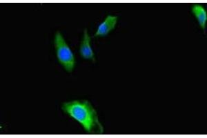 Immunofluorescent analysis of Hela cells using ABIN7171622 at dilution of 1:100 and Alexa Fluor 488-congugated AffiniPure Goat Anti-Rabbit IgG(H+L) (TBC1D24 anticorps  (AA 1-169))