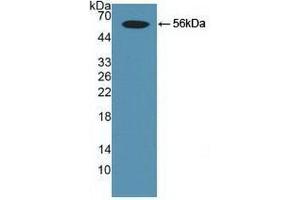 Detection of Recombinant Smad9, Human using Polyclonal Antibody to SMAD family member 9 (SMAD9)