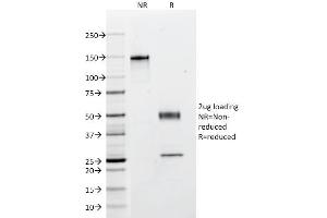 SDS-PAGE Analysis Purified Multi Cytokeratin Mouse Monoclonal Antibody (C11). (KRT4, KRT5, KRT6, KRT8, KRT10, KRT13, KRT18 anticorps)