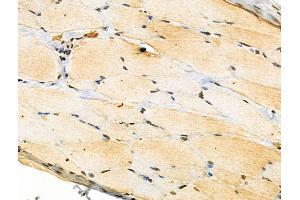 Phospho-Ephrin B1/B2/B3 (Tyr324) Antibody at 1/100 staining Rat skin tissue by IHC-P. (Ephrin B1/B2/B3 (EFNB1/2/3) (pTyr324) anticorps)