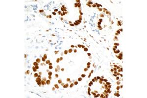 Immunohistochemistry (IHC) image for anti-Fused in Sarcoma (FUS) (AA 1-50) antibody (ABIN7454040)