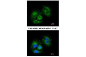 ICC/IF Image Immunofluorescence analysis of methanol-fixed A549, using SIRT3, antibody at 1:200 dilution.
