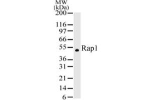 Image no. 1 for anti-Telomeric Repeat Binding Factor 2, Interacting Protein (TERF2IP) (AA 212-235) antibody (ABIN208517) (RAP1 anticorps  (AA 212-235))