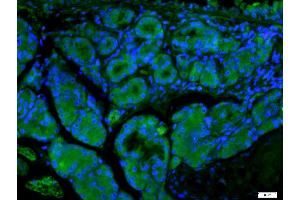 Paraformaldehyde-fixed, paraffin embedded Mouse esophagus, Antigen retrieval by boiling in sodium citrate buffer (pH6) for 15min, Block endogenous peroxidase by 3% hydrogen peroxide for 20 minutes, Blocking buffer (normal goat serum) at 37°C for 30min, Antibody incubation with ECM1 Polyclonal Antibody, Unconjugated  at 1:400 overnight at 4°C, followed by a FITC conjugated secondary antibody for 90minutes at 37°C and DAPI for nuclei staining.