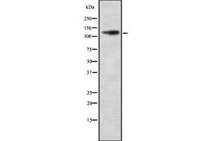 Western blot analysis ITGAD using COLO205 whole cell lysates (ITGAD anticorps  (Internal Region))