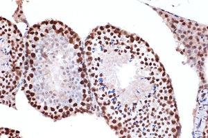 Immunohistochemistry of paraffin-embedded mouse testis using FUBP1 Rabbit mAb (ABIN7267128) at dilution of 1:100 (40x lens). (FUBP1 anticorps)