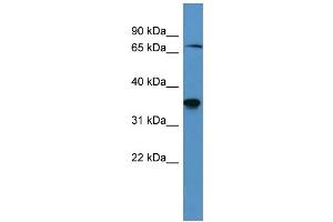 Western Blotting (WB) image for anti-SH3-Domain Binding Protein 5 (SH3BP5) (C-Term) antibody (ABIN2788422) (SH3BP5 anticorps  (C-Term))