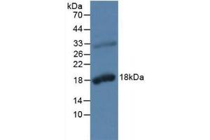 Detection of KLK2 in Rat Prostate Gland Tissue using Polyclonal Antibody to Kallikrein 2 (KLK2)