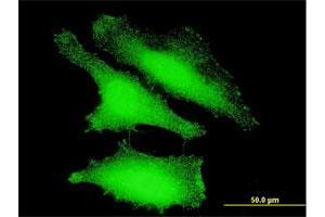 Immunofluorescence of monoclonal antibody to FOXO1 on HeLa cell. (FOXO1 anticorps  (AA 556-655))