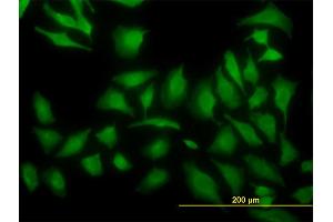 Immunofluorescence of monoclonal antibody to ARF5 on HeLa cell. (ARF5 anticorps  (AA 81-180))
