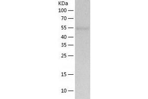 Western Blotting (WB) image for TBC1 Domain Family, Member 22B (TBC1D22B) (AA 1-505) protein (His-IF2DI Tag) (ABIN7125329)