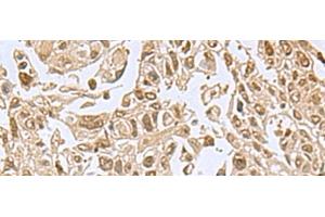 anti-Nuclear VCP-Like (NVL) antibody