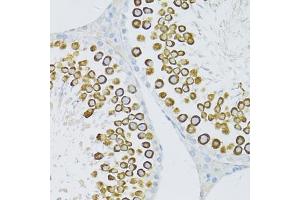 Immunohistochemistry of paraffin-embedded rat testis using PIWIL1 antibody (ABIN5971177) at dilution of 1/100 (40x lens).