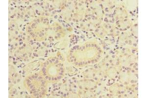 Immunohistochemistry of paraffin-embedded human pancreatic tissue using ABIN7171662 at dilution of 1:100 (TBC1D9B anticorps  (AA 724-1023))