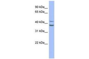 Image no. 1 for anti-Plasminogen Activator Inhibitor 2 (SERPINB2) (AA 179-228) antibody (ABIN6744064) (SERPINB2 anticorps  (AA 179-228))