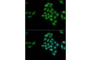 Immunofluorescence analysis of MCF7 cells using KLK10 antibody (ABIN6142943). (Kallikrein 10 anticorps  (AA 35-276))