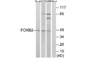 Western blot analysis of extracts from HeLa cells, LOVO cells and A549 cells, using FOXB2 antibody. (FOXB2 anticorps  (Internal Region))