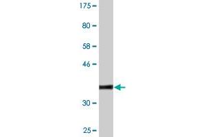 Western Blot detection against Immunogen (37.