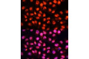 Immunofluorescence analysis of HeLa cells using STXBP1 antibody (ABIN6128255, ABIN6148673, ABIN6148674 and ABIN6221073) at dilution of 1:100 (40x lens).
